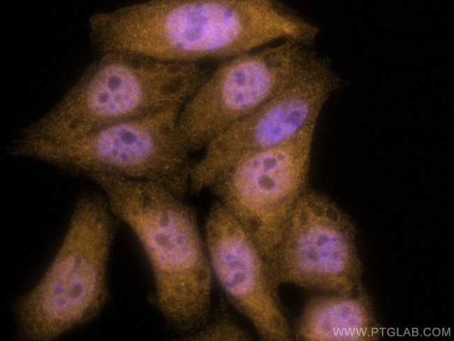 TIA1 Antibody in Immunocytochemistry (ICC/IF)