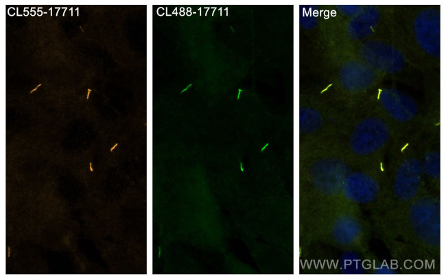 ARL13B Antibody in Immunocytochemistry (ICC/IF)