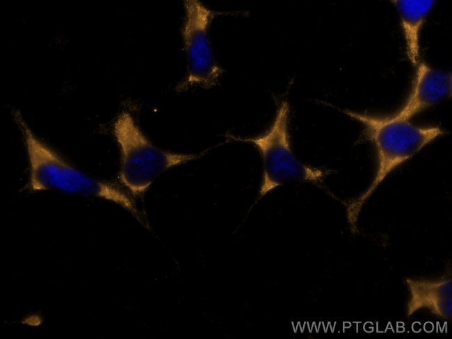 Chromogranin A Antibody in Immunocytochemistry (ICC/IF)
