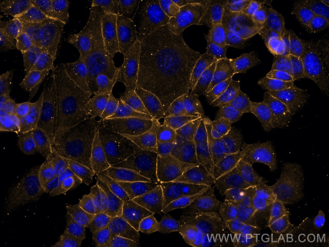 E-cadherin Antibody in Immunocytochemistry (ICC/IF)