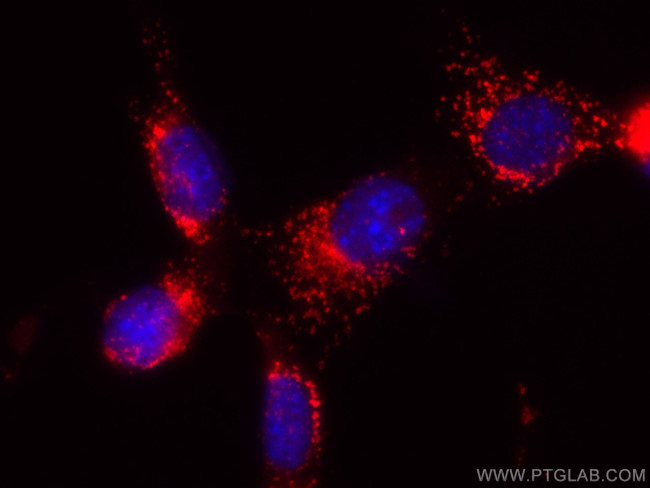 CD107a/LAMP1 Antibody in Immunocytochemistry (ICC/IF)