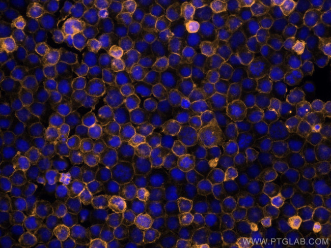 CD45 Antibody in Immunocytochemistry (ICC/IF)