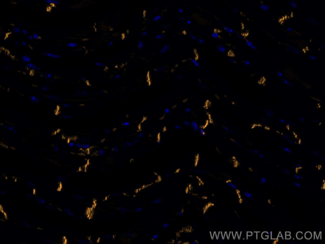 N-cadherin Antibody in Immunohistochemistry (PFA fixed) (IHC (PFA))