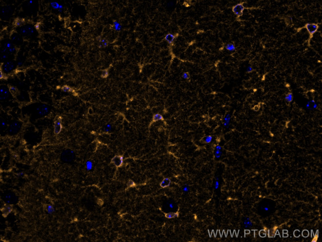 Glutamine Synthetase Antibody in Immunohistochemistry (PFA fixed) (IHC (PFA))