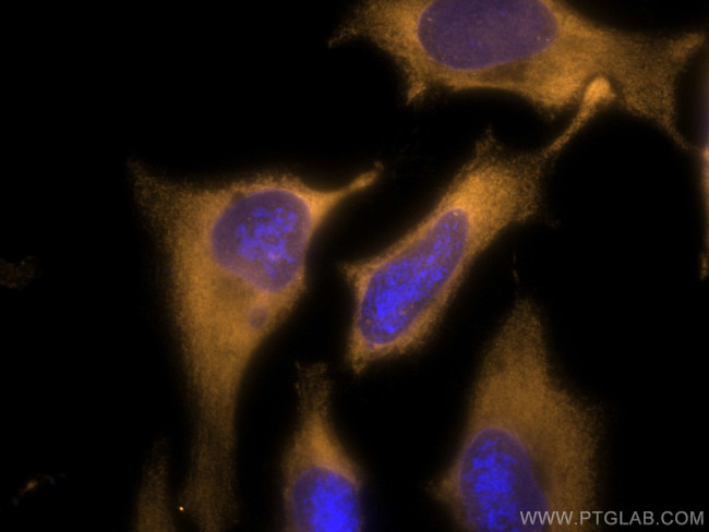 CAPRIN1 Antibody in Immunocytochemistry (ICC/IF)