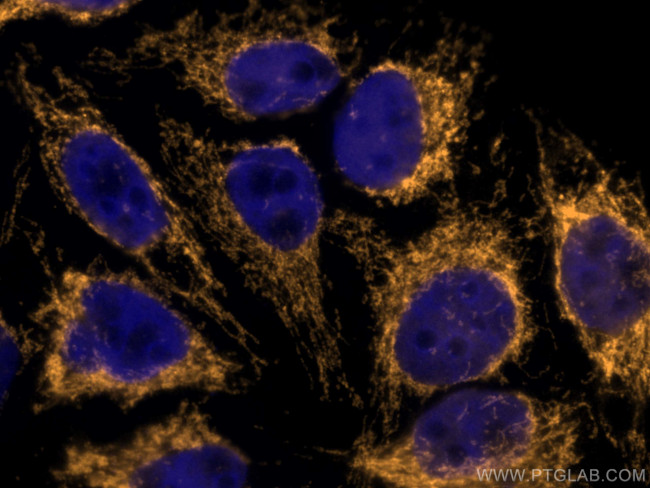 Tom22 Antibody in Immunocytochemistry (ICC/IF)