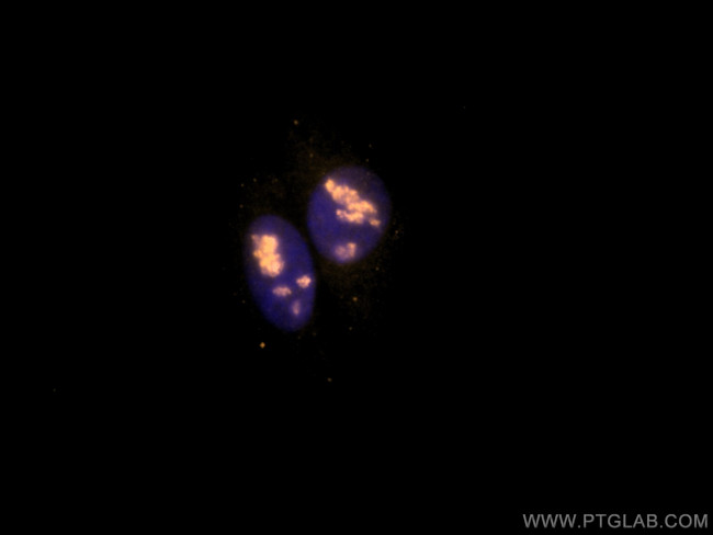 DDX21 Antibody in Immunocytochemistry (ICC/IF)
