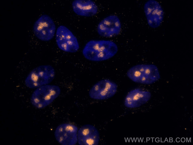 FBL Antibody in Immunocytochemistry (ICC/IF)