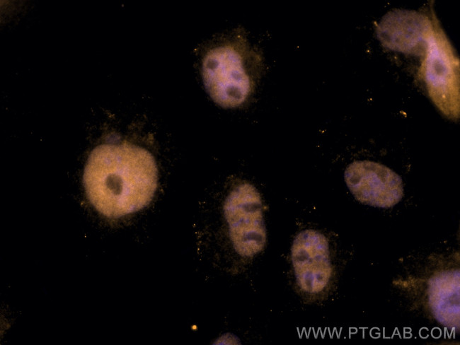 ANKRD1 Antibody in Immunocytochemistry (ICC/IF)