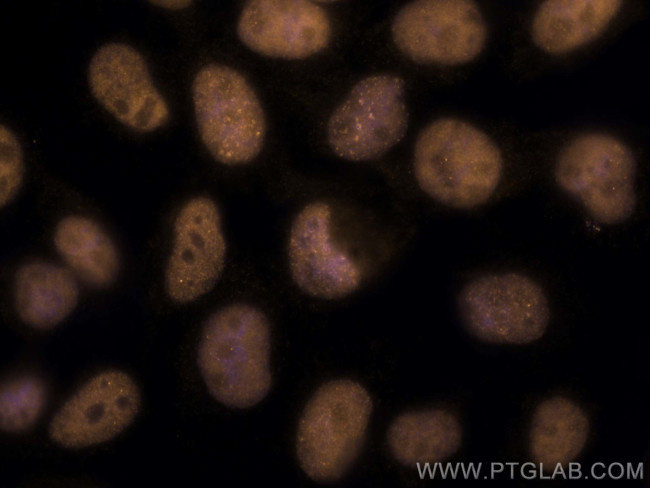 RPA2 Antibody in Immunocytochemistry (ICC/IF)