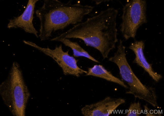 DNM2 Antibody in Immunocytochemistry (ICC/IF)