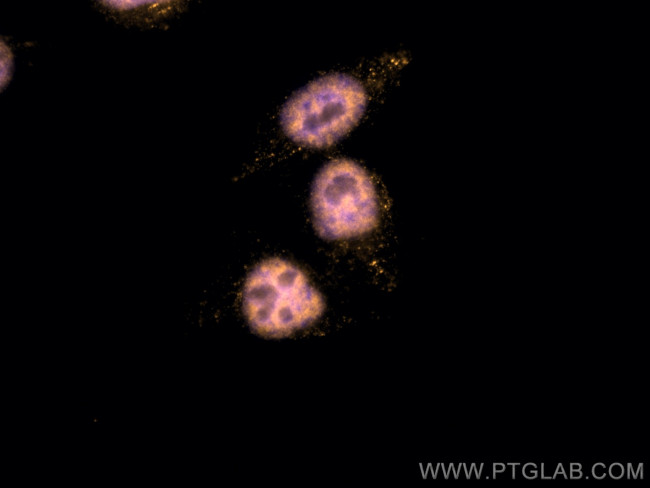 P53 Antibody in Immunocytochemistry (ICC/IF)