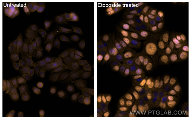 Phospho-P53 (Ser15) Antibody in Immunocytochemistry (ICC/IF)