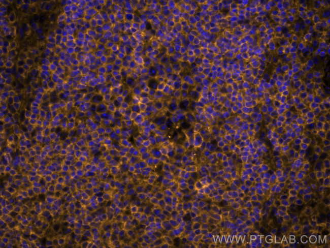 CD45 Antibody in Immunohistochemistry (PFA fixed) (IHC (PFA))