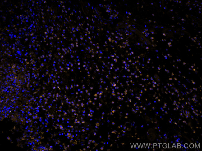 BCL2 Antibody in Immunohistochemistry (PFA fixed) (IHC (PFA))