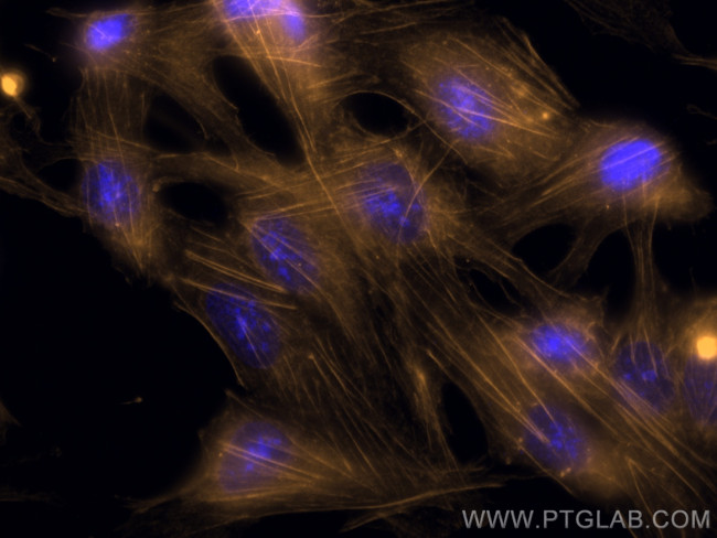 Beta Actin Antibody in Immunocytochemistry (ICC/IF)