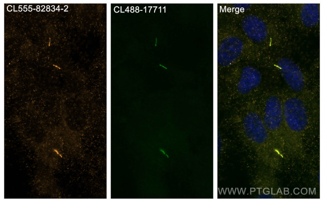 ARL13B Antibody in Immunocytochemistry (ICC/IF)