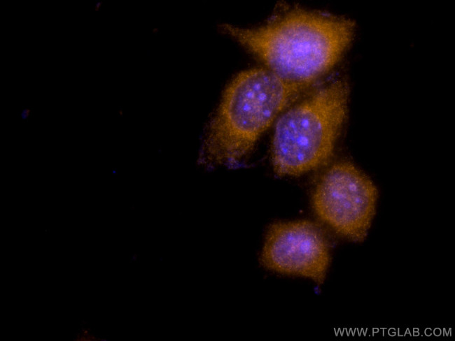 S100A6 Antibody in Immunocytochemistry (ICC/IF)