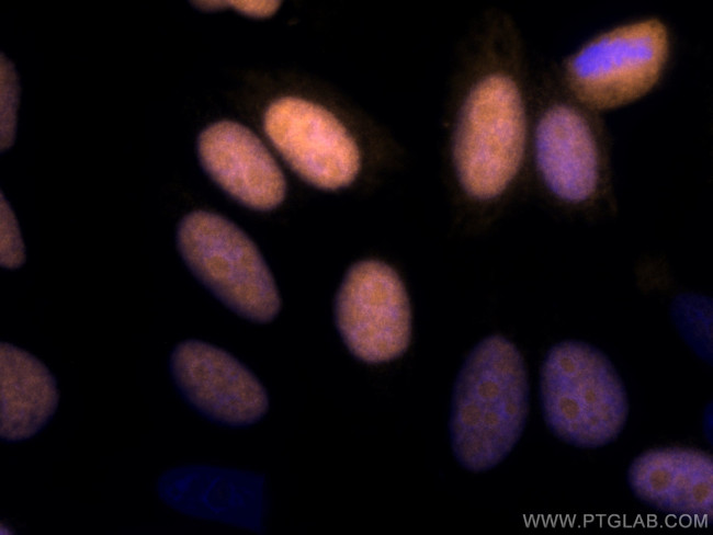 Geminin Antibody in Immunocytochemistry (ICC/IF)