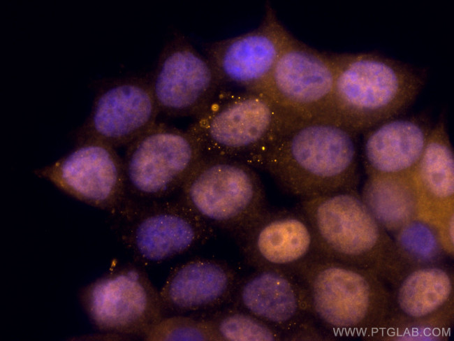 CDK4 Antibody in Immunocytochemistry (ICC/IF)