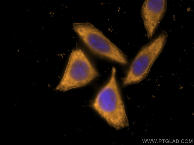 ENO1 Antibody in Immunocytochemistry (ICC/IF)