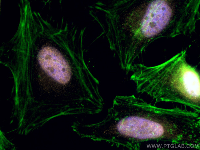 VPRBP Antibody in Immunocytochemistry (ICC/IF)