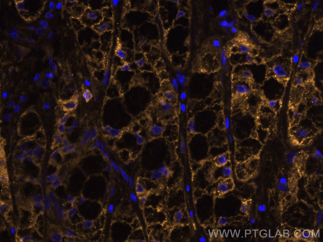 ASGR1 Antibody in Immunohistochemistry (Paraffin) (IHC (P))