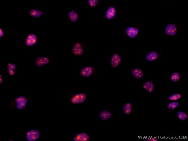 Cyclin E2 Antibody in Immunocytochemistry (ICC/IF)
