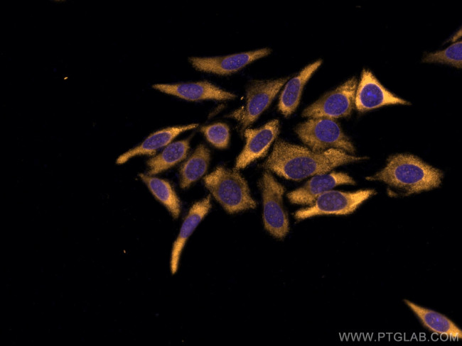 MEK6 Antibody in Immunocytochemistry (ICC/IF)