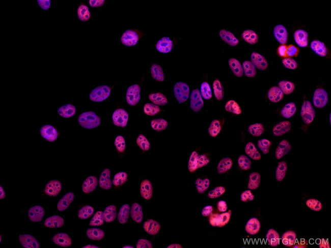 HDAC2 Antibody in Immunocytochemistry (ICC/IF)