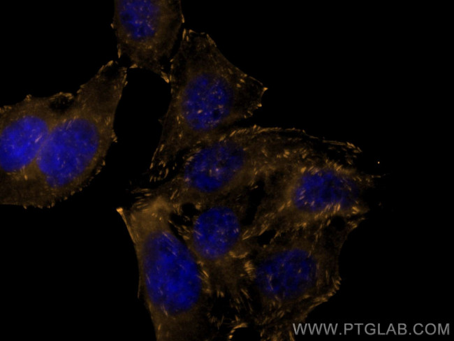 VASP Antibody in Immunocytochemistry (ICC/IF)