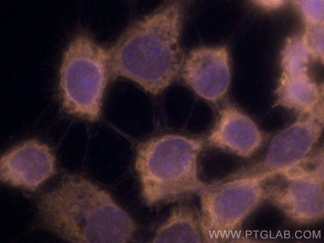 Beta-2-Microglobulin Antibody in Immunocytochemistry (ICC/IF)