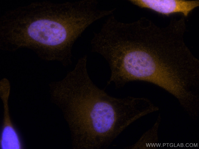 Thymidylate synthase Antibody in Immunocytochemistry (ICC/IF)
