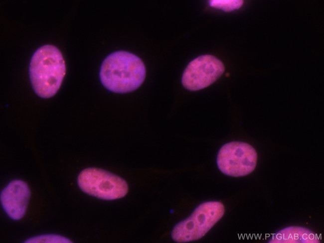 KAP1 Antibody in Immunocytochemistry (ICC/IF)