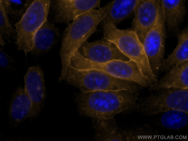 HLA class I ABC Antibody in Immunocytochemistry (ICC/IF)