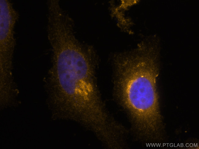 GS28 Antibody in Immunocytochemistry (ICC/IF)