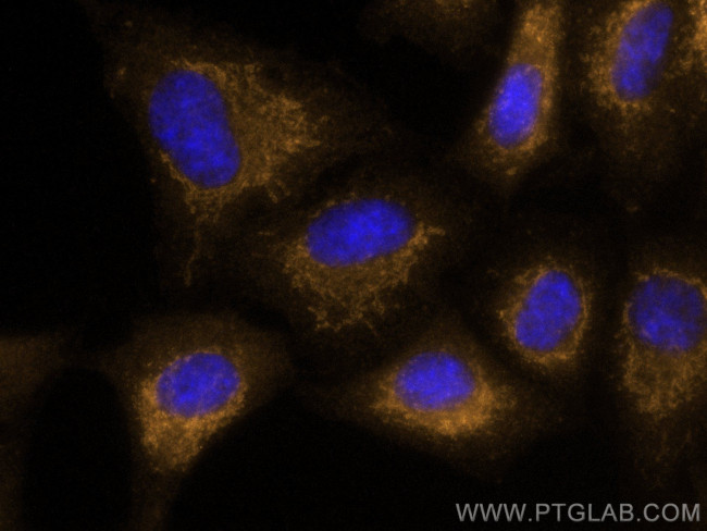 BCL10 Antibody in Immunocytochemistry (ICC/IF)