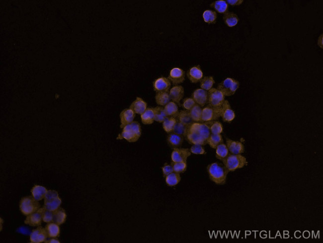 ITK Antibody in Immunocytochemistry (ICC/IF)