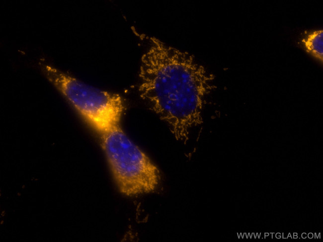C1QBP Antibody in Immunocytochemistry (ICC/IF)