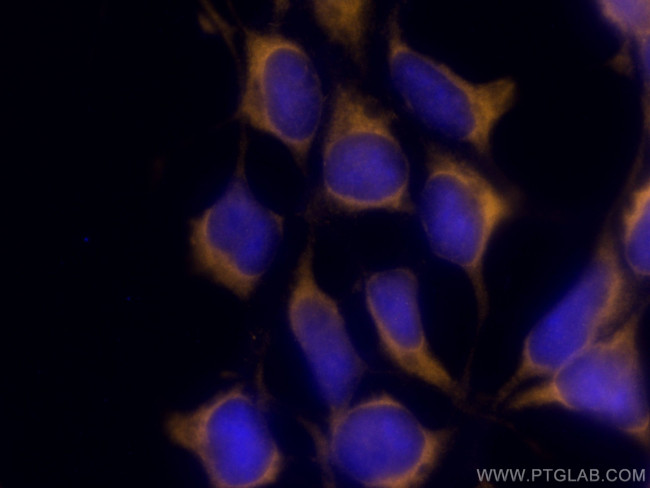 CITED1 Antibody in Immunocytochemistry (ICC/IF)