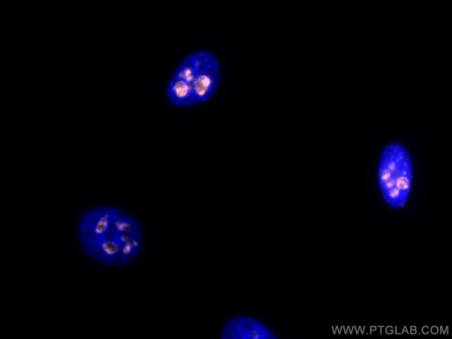 KI67 Antibody in Immunocytochemistry (ICC/IF)