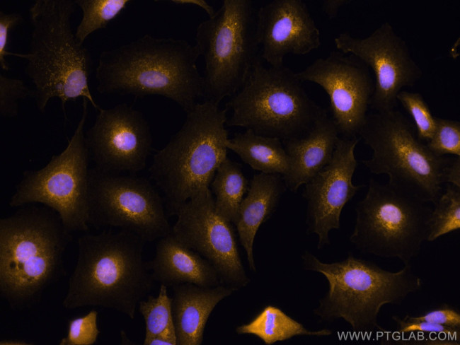 BCL10 Antibody in Immunocytochemistry (ICC/IF)