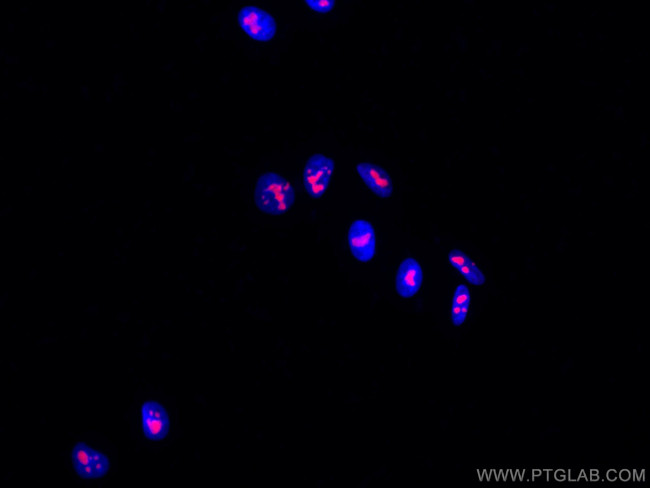 B23/NPM1 Antibody in Immunocytochemistry (ICC/IF)