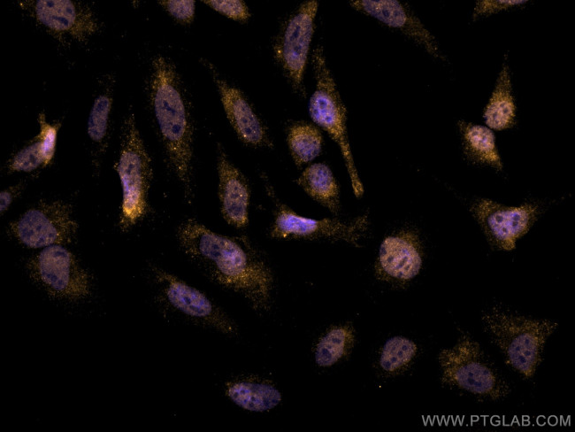 RBM4 Antibody in Immunocytochemistry (ICC/IF)