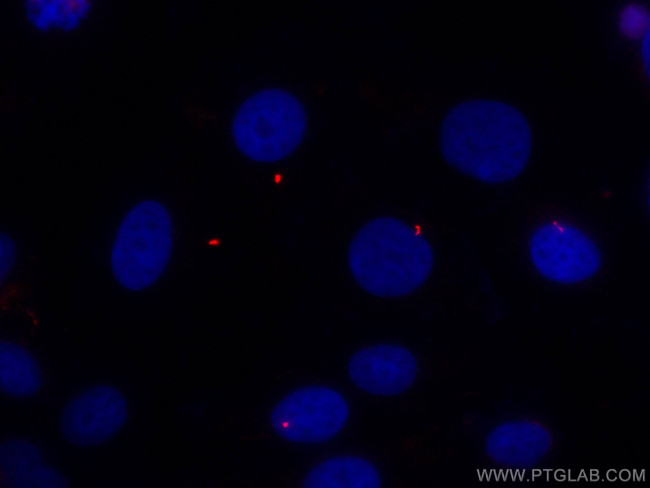 acetylated Tubulin (Lys40) Antibody in Immunocytochemistry (ICC/IF)