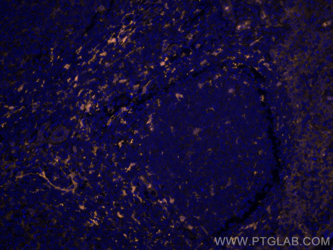 Fascin Antibody in Immunohistochemistry (Paraffin) (IHC (P))