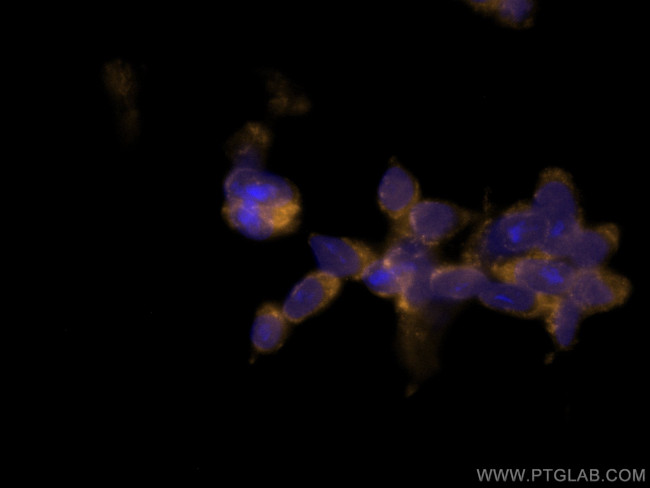 Calretinin Antibody in Immunocytochemistry (ICC/IF)