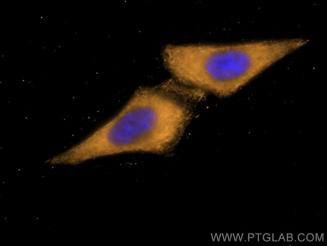 Beta Galactosidase Antibody in Immunocytochemistry (ICC/IF)