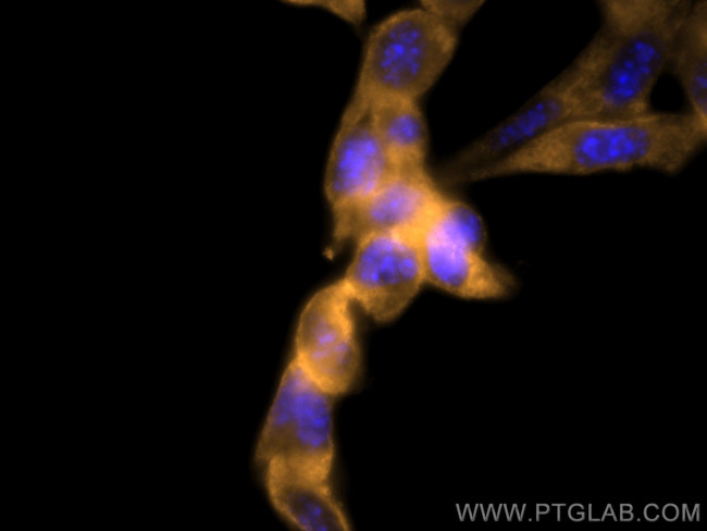 Bcl2 Antibody in Immunocytochemistry (ICC/IF)