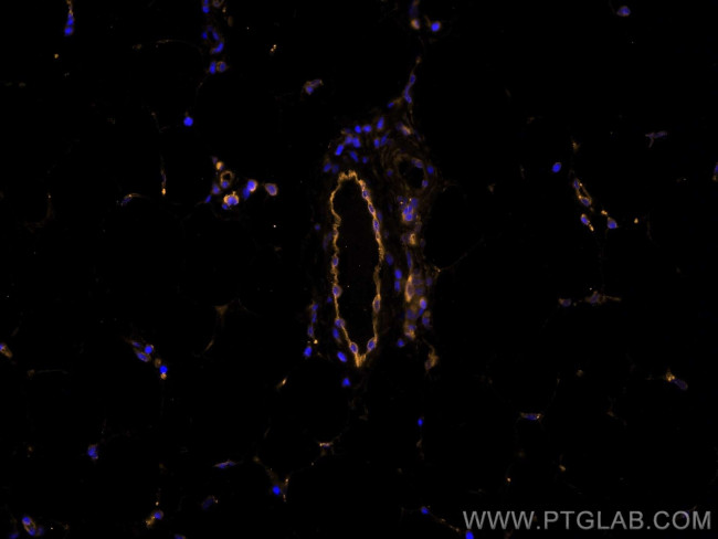 Endoglin/CD105 Antibody in Immunohistochemistry (Paraffin) (IHC (P))